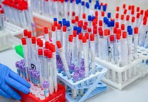 Медработников в Москве проверяют экспресс-тестами на иммунитет к COVID-19. Фото: сайт мэра Москвы